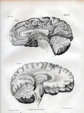 brainlith1-320x430