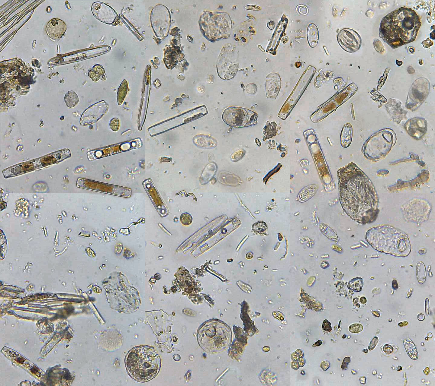 Бактерии в копрограмме. Цисты лямблии микроскопия. Яйца гельминтов микроскопия. Цисты лямблий микроскопия. Яйца гельминтов микроскопия атлас.