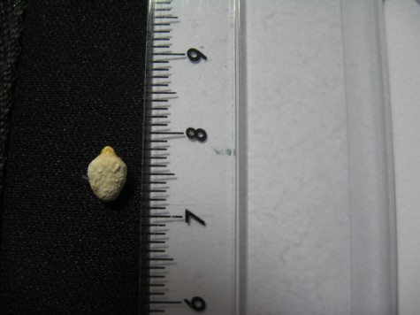 First stone (cm)